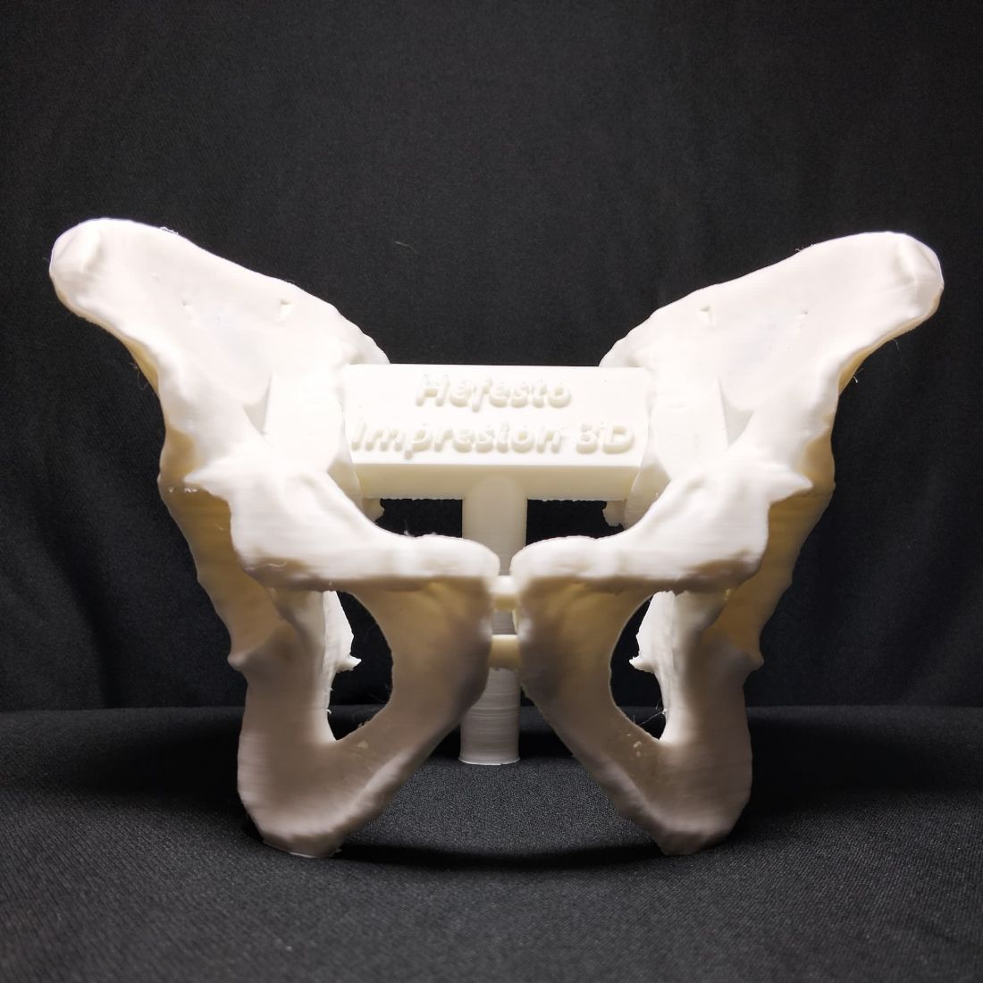 Modelo anatómico 3D de pelvis — Hefestech